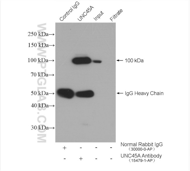 UNC45A Antibody in Immunoprecipitation (IP)