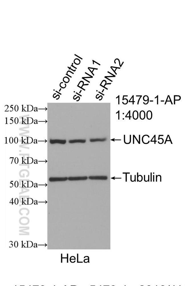 UNC45A Antibody in Western Blot (WB)