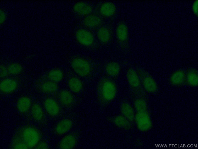 ADAT1 Antibody in Immunocytochemistry (ICC/IF)