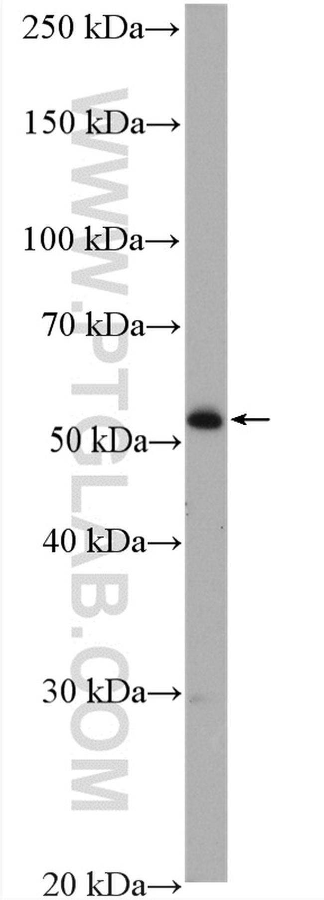 ADAT1 Antibody in Western Blot (WB)