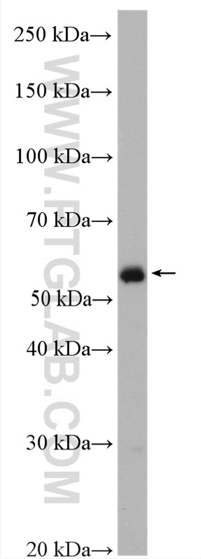 ADAT1 Antibody in Western Blot (WB)