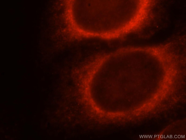 DNAJB11 Antibody in Immunocytochemistry (ICC/IF)