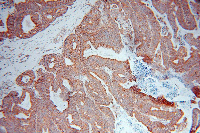 DNAJB11 Antibody in Immunohistochemistry (Paraffin) (IHC (P))