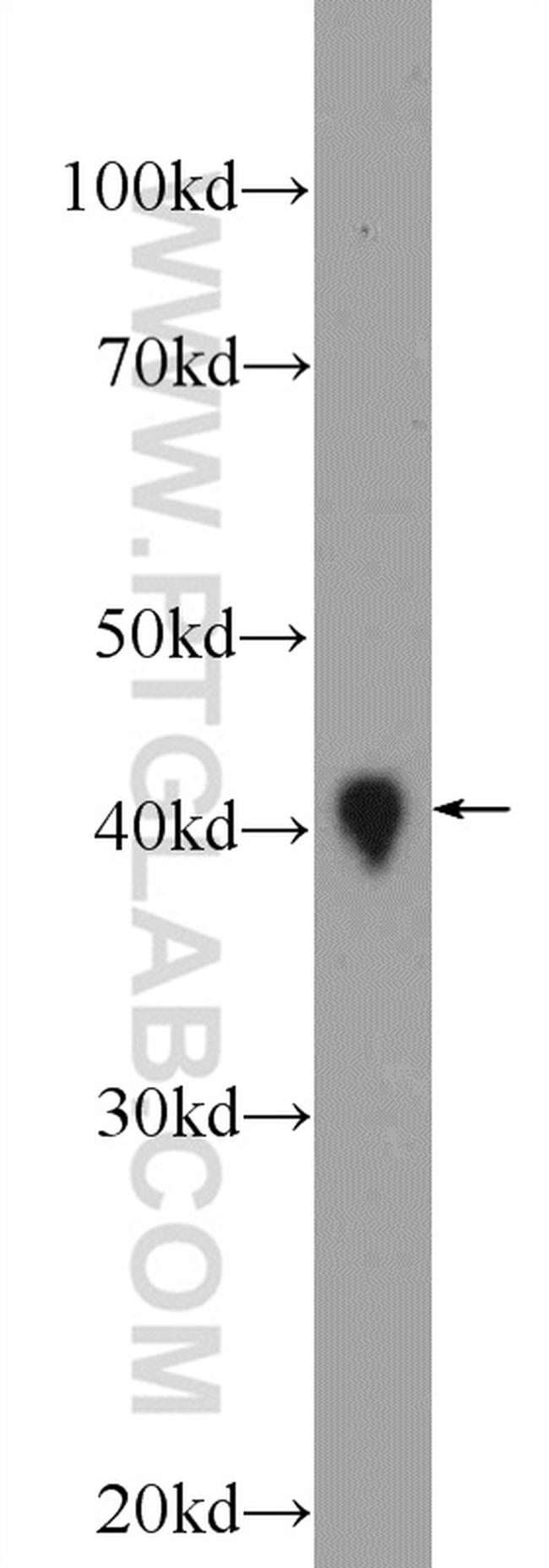 DNAJB11 Antibody in Western Blot (WB)