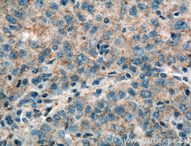 RAB31 Antibody in Immunohistochemistry (Paraffin) (IHC (P))