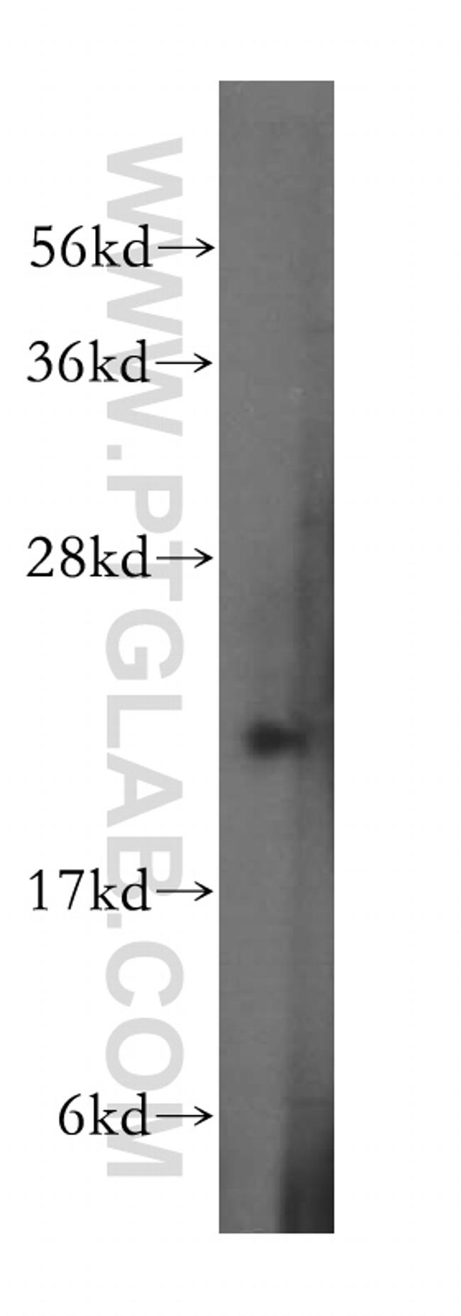 RAB31 Antibody in Western Blot (WB)