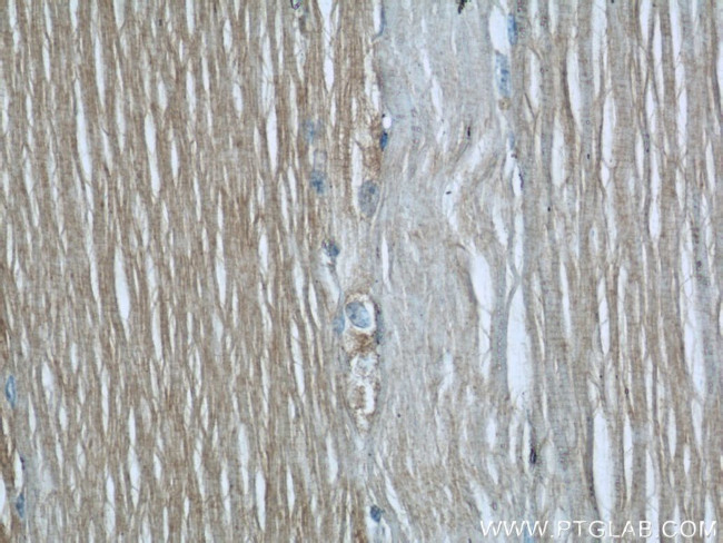 UBE2E3 Antibody in Immunohistochemistry (Paraffin) (IHC (P))