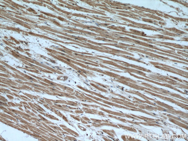 UBE2E3 Antibody in Immunohistochemistry (Paraffin) (IHC (P))