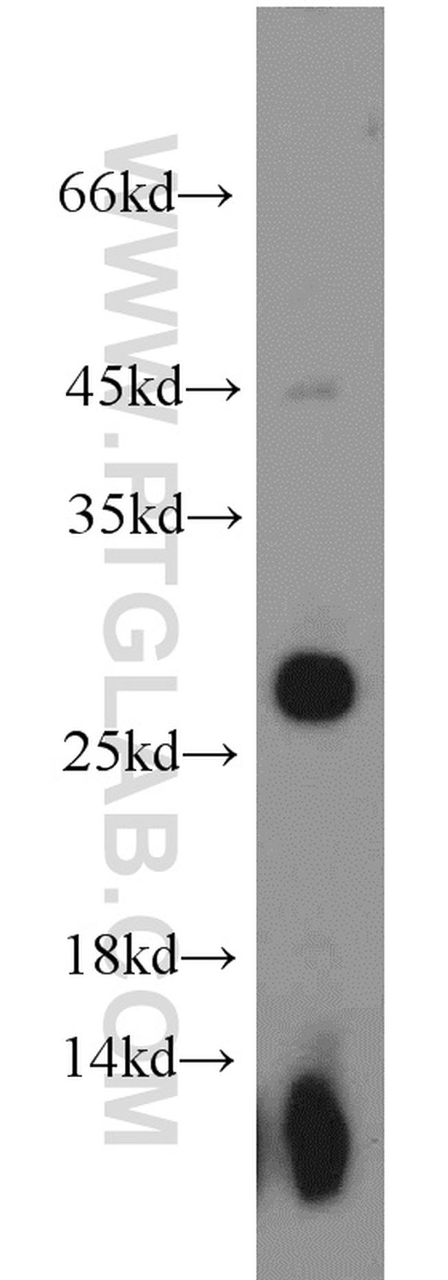 UBE2E3 Antibody in Western Blot (WB)