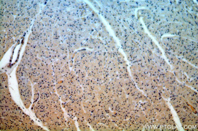 CPSF6 Antibody in Immunohistochemistry (Paraffin) (IHC (P))