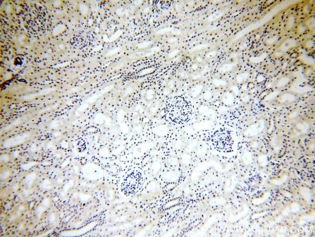 CPSF6 Antibody in Immunohistochemistry (Paraffin) (IHC (P))