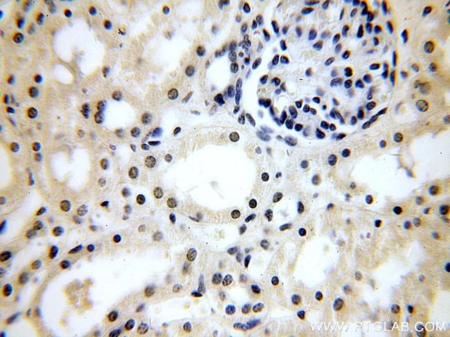 CPSF6 Antibody in Immunohistochemistry (Paraffin) (IHC (P))