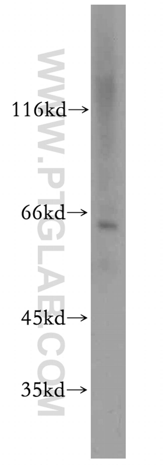 CPSF6 Antibody in Western Blot (WB)