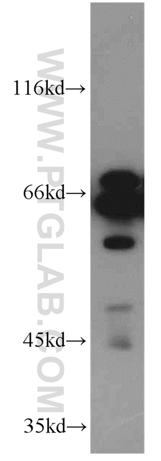 CPSF6 Antibody in Western Blot (WB)