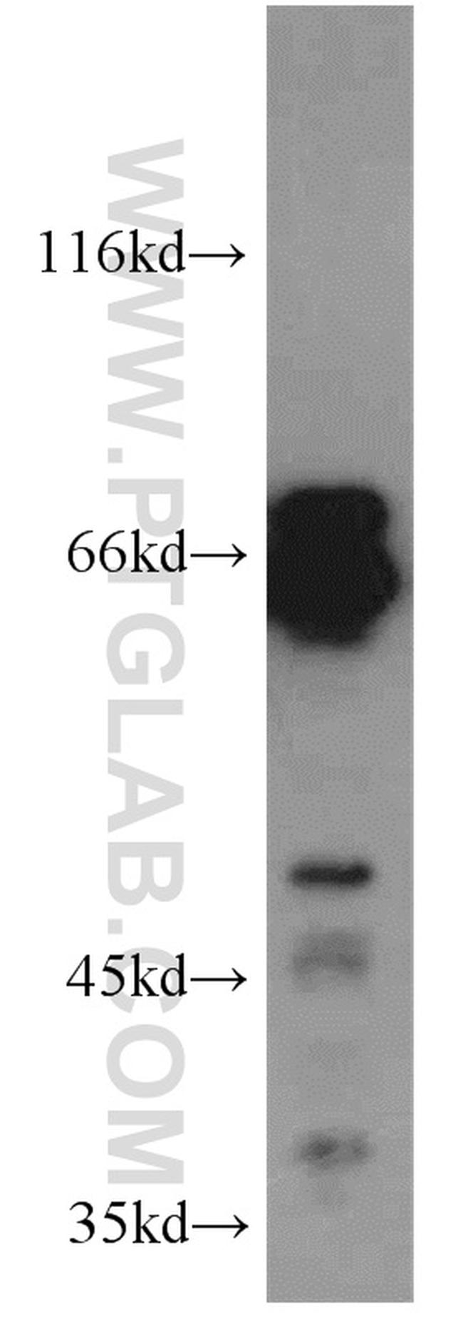 CPSF6 Antibody in Western Blot (WB)