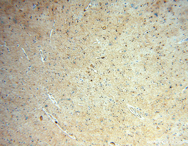 SCNM1 Antibody in Immunohistochemistry (Paraffin) (IHC (P))