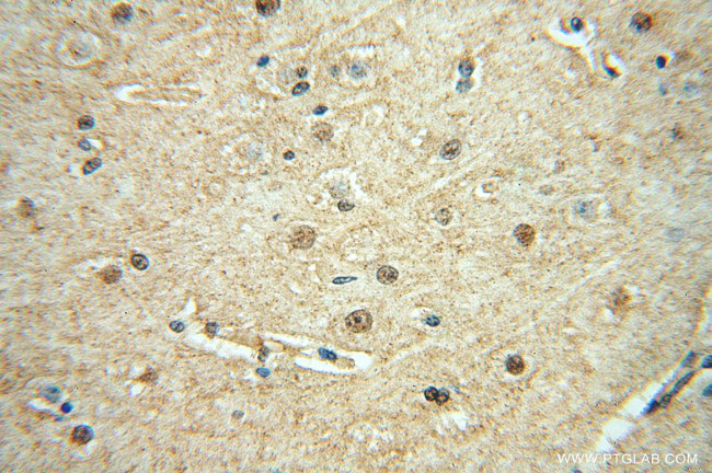 SCNM1 Antibody in Immunohistochemistry (Paraffin) (IHC (P))