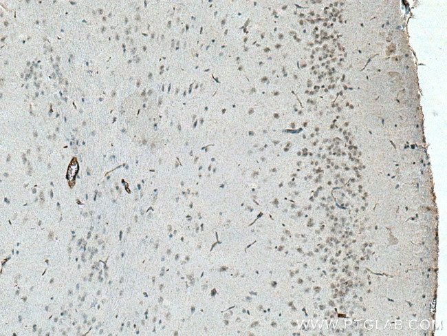 SCNM1 Antibody in Immunohistochemistry (Paraffin) (IHC (P))