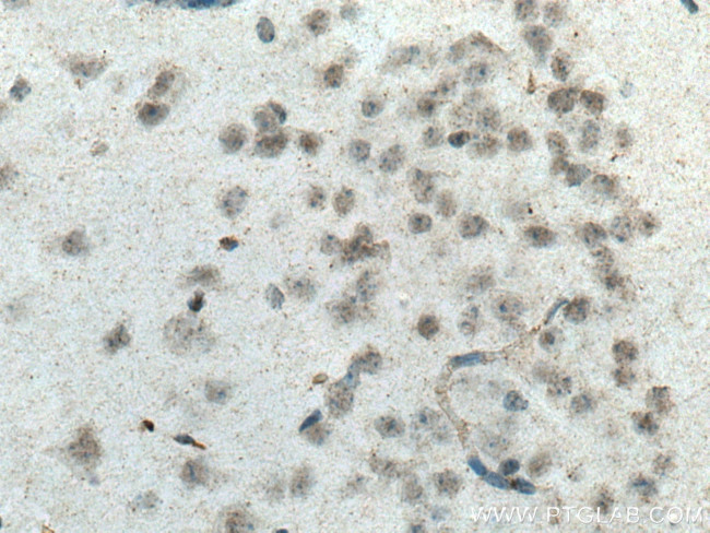 SCNM1 Antibody in Immunohistochemistry (Paraffin) (IHC (P))