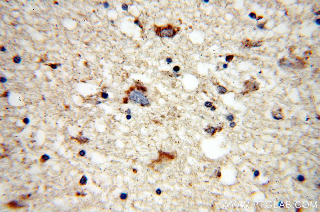 MARK2 Antibody in Immunohistochemistry (Paraffin) (IHC (P))