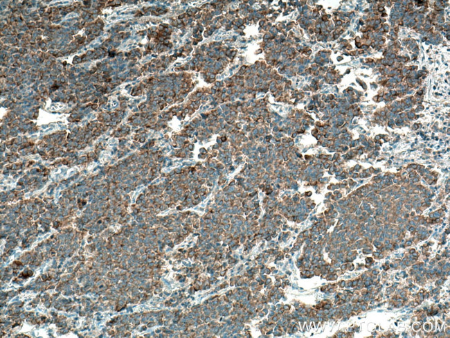 MARK2 Antibody in Immunohistochemistry (Paraffin) (IHC (P))