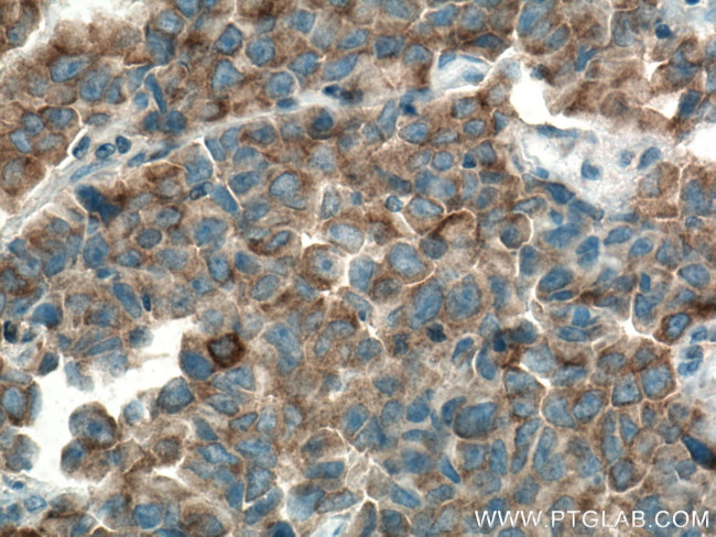 MARK2 Antibody in Immunohistochemistry (Paraffin) (IHC (P))