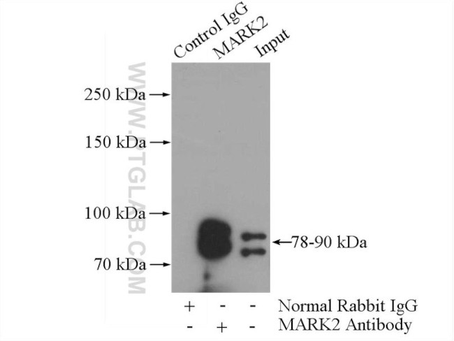 MARK2 Antibody in Immunoprecipitation (IP)