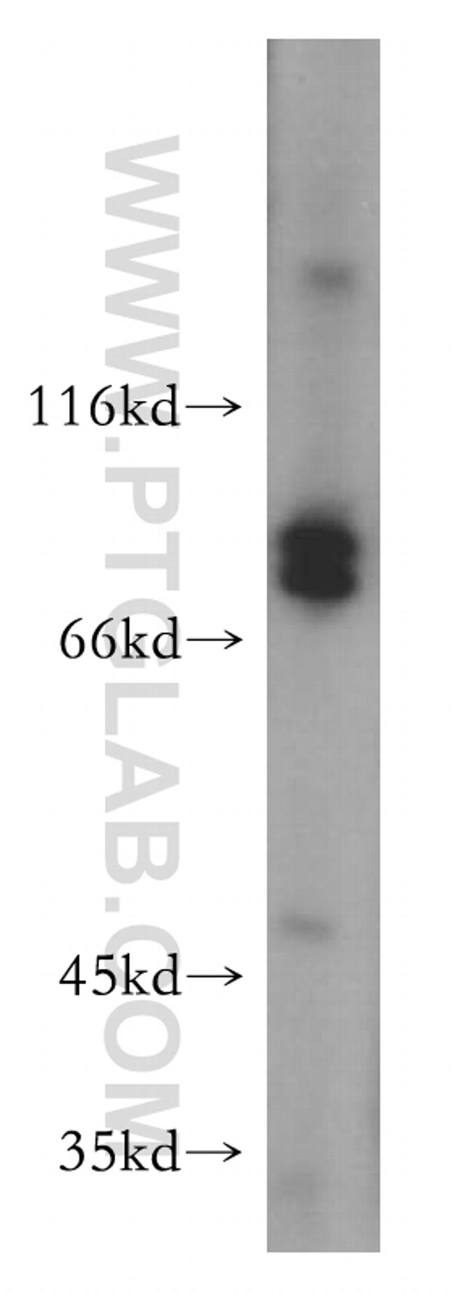 MARK2 Antibody in Western Blot (WB)