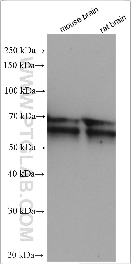 RUNX1T1 Antibody in Western Blot (WB)