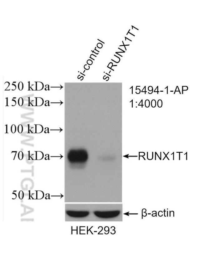 RUNX1T1 Antibody in Western Blot (WB)