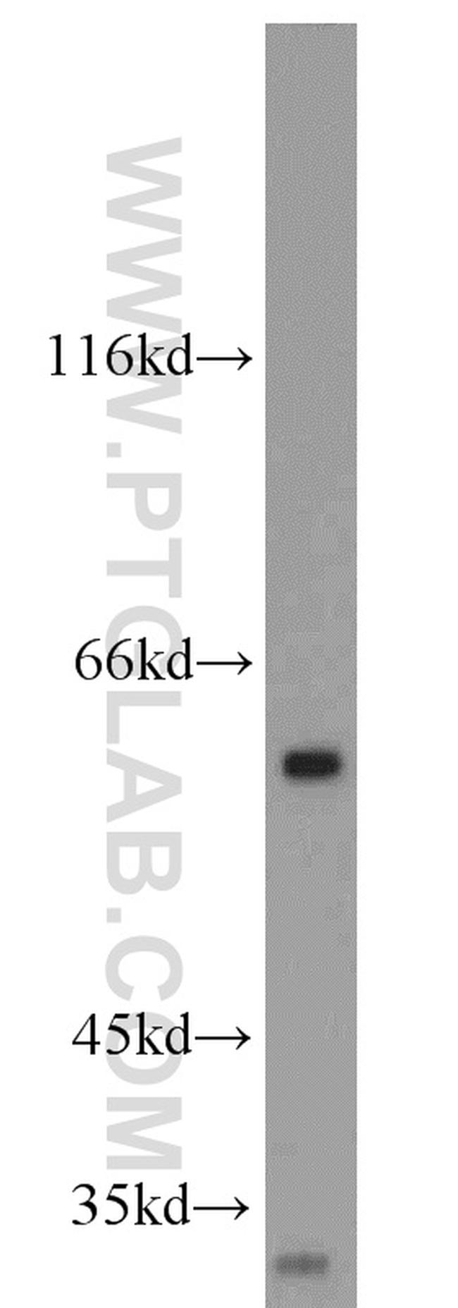 DR5 Antibody in Western Blot (WB)