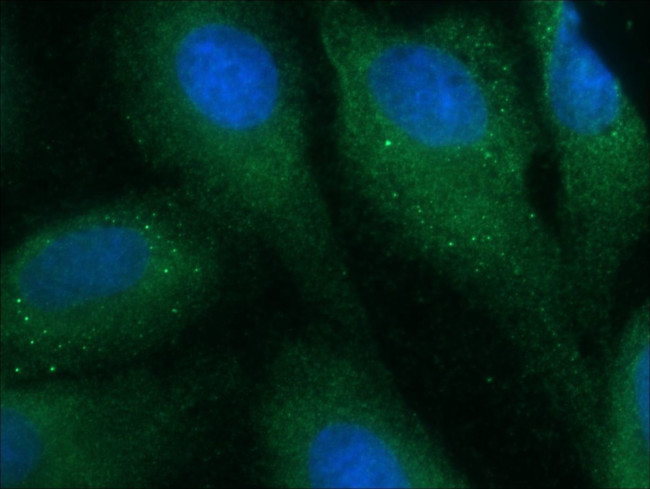 DISC1-long Antibody in Immunocytochemistry (ICC/IF)