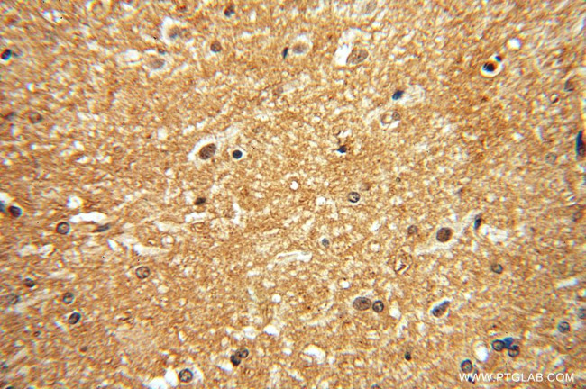 DISC1-long Antibody in Immunohistochemistry (Paraffin) (IHC (P))