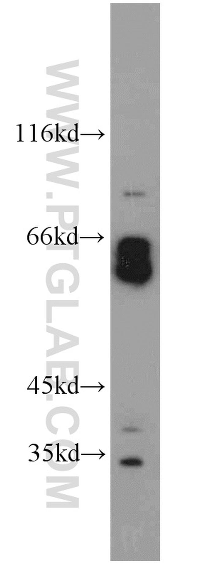 DISC1-long Antibody in Western Blot (WB)