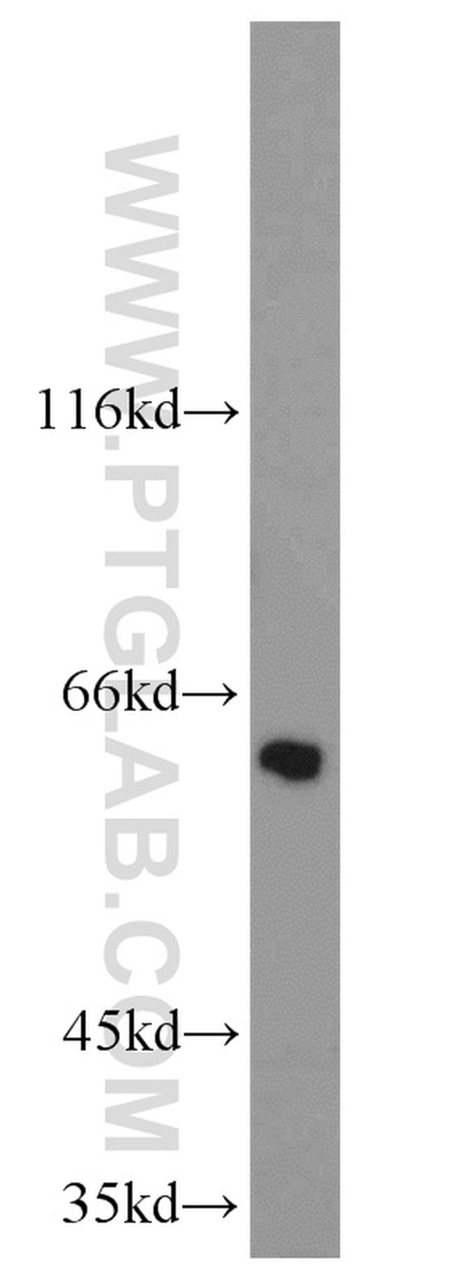 DISC1-long Antibody in Western Blot (WB)