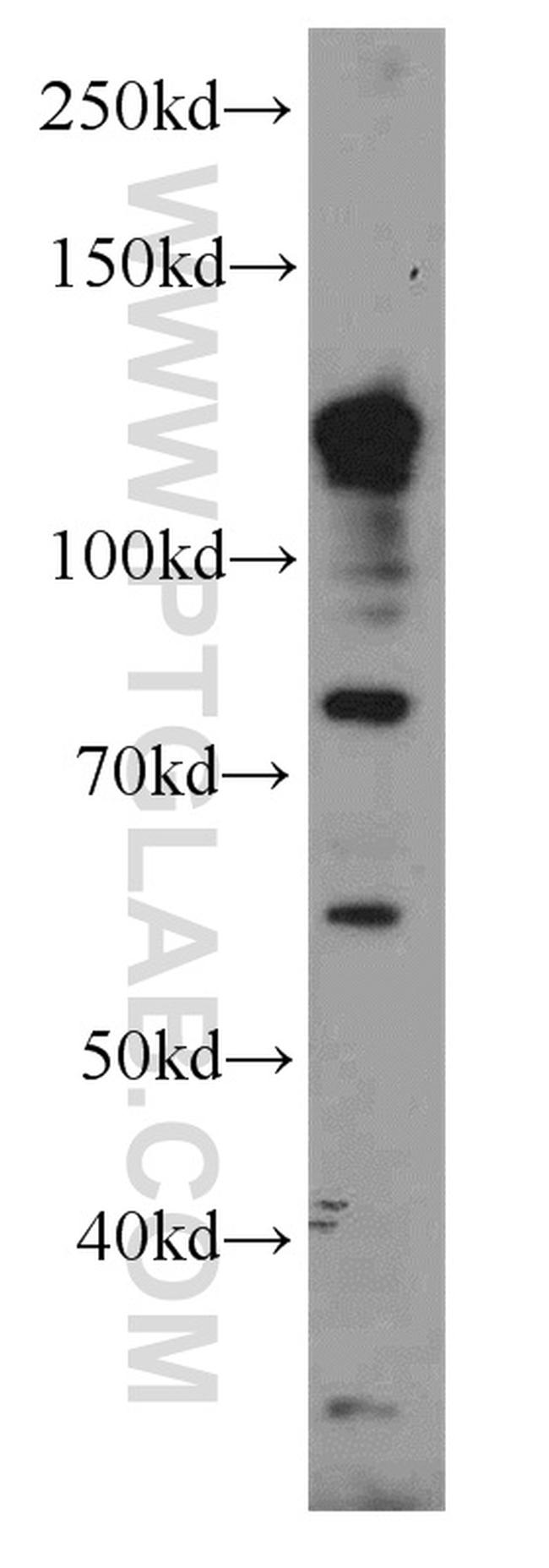 DISC1-long Antibody in Western Blot (WB)