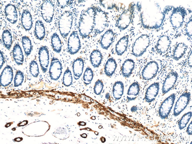 transgelin/SM22 Antibody in Immunohistochemistry (Paraffin) (IHC (P))