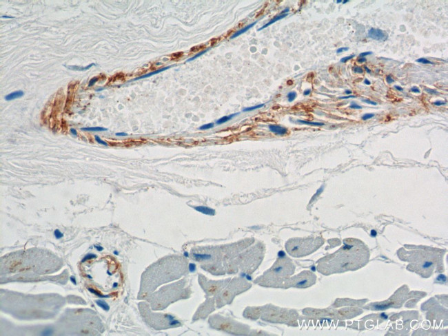 transgelin/SM22 Antibody in Immunohistochemistry (Paraffin) (IHC (P))