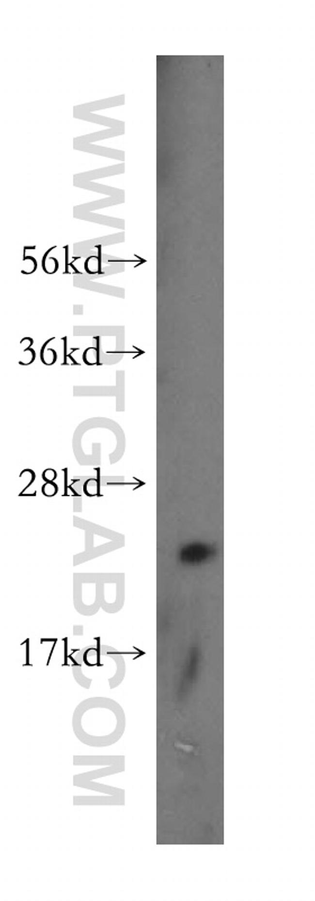 transgelin/SM22 Antibody in Western Blot (WB)