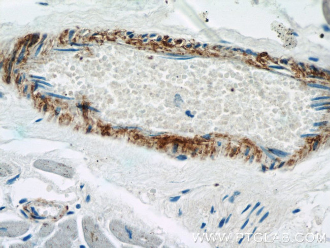 transgelin/SM22 Antibody in Immunohistochemistry (Paraffin) (IHC (P))