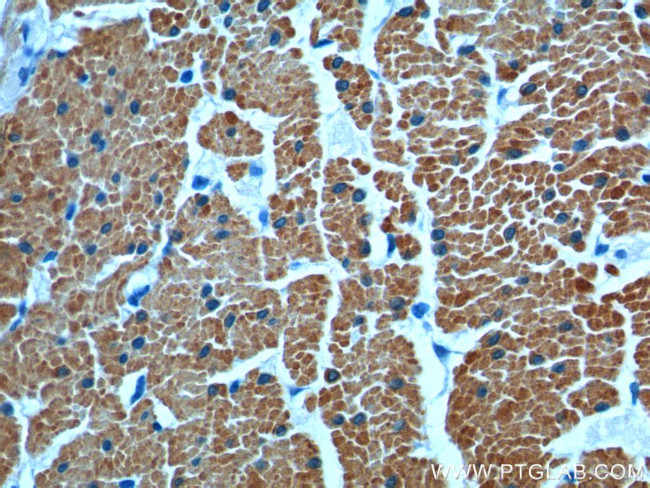 transgelin/SM22 Antibody in Immunohistochemistry (Paraffin) (IHC (P))