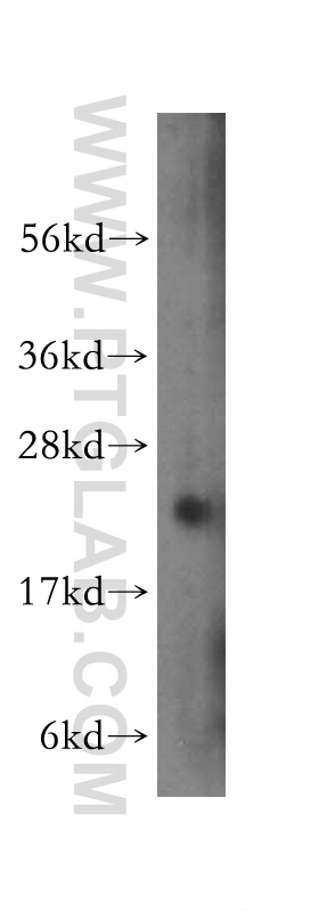 transgelin/SM22 Antibody in Western Blot (WB)