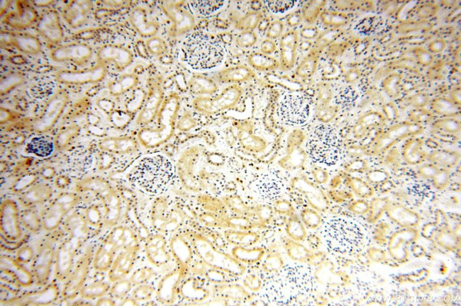 NFKB2 p52/p100 Antibody in Immunohistochemistry (Paraffin) (IHC (P))