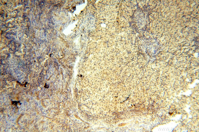 NFKB2 p52/p100 Antibody in Immunohistochemistry (Paraffin) (IHC (P))