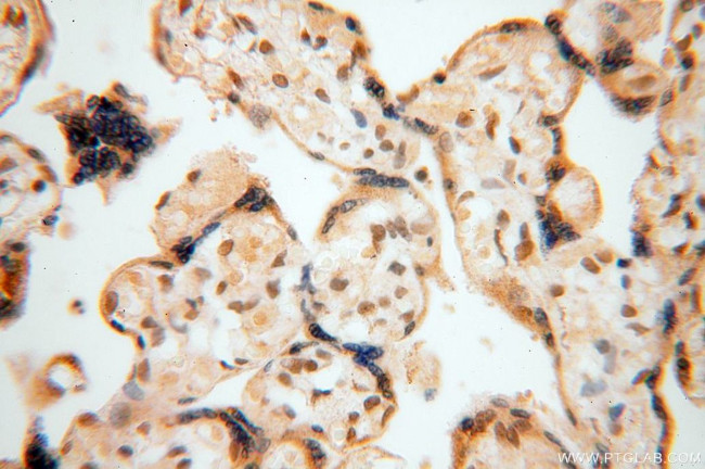 NFKB2 p52/p100 Antibody in Immunohistochemistry (Paraffin) (IHC (P))