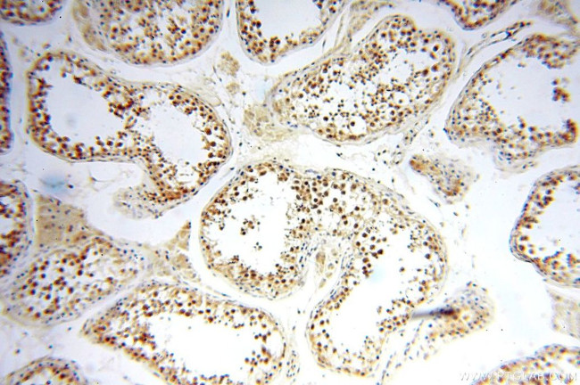 NFKB2 p52/p100 Antibody in Immunohistochemistry (Paraffin) (IHC (P))