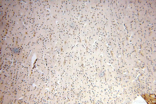 NFKB2 p52/p100 Antibody in Immunohistochemistry (Paraffin) (IHC (P))