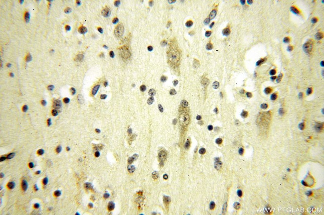 NFKB2 p52/p100 Antibody in Immunohistochemistry (Paraffin) (IHC (P))