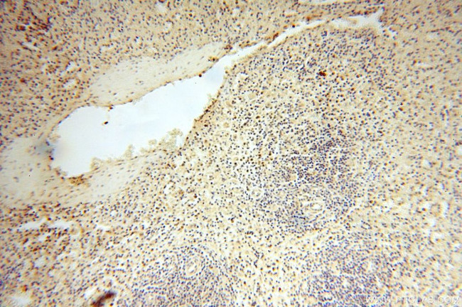 NFKB2 p52/p100 Antibody in Immunohistochemistry (Paraffin) (IHC (P))