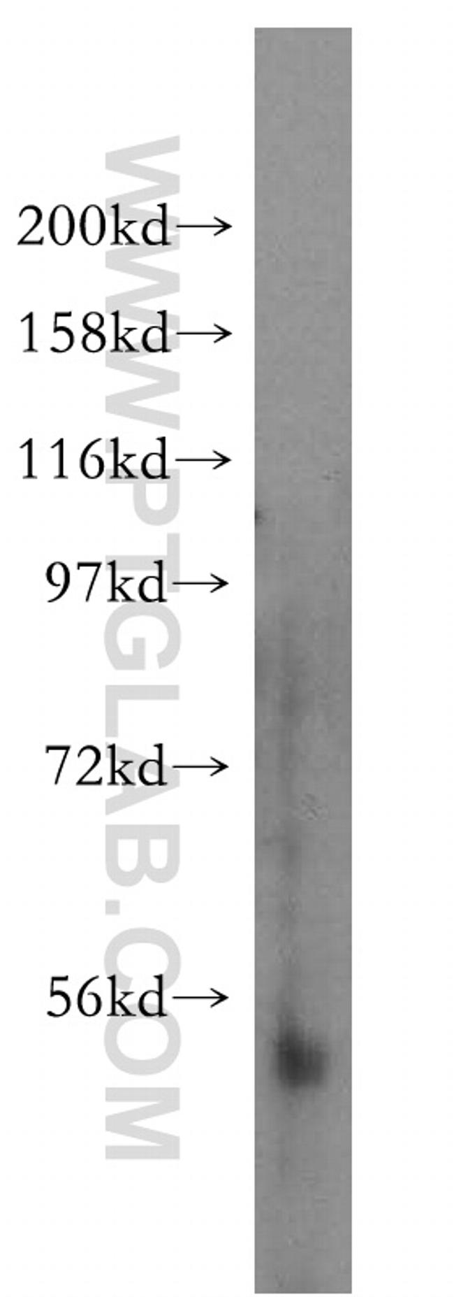 NFKB2 p52/p100 Antibody in Western Blot (WB)